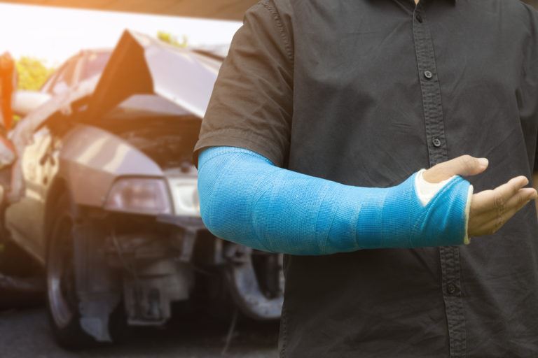 Man wearing blue cast near car accident